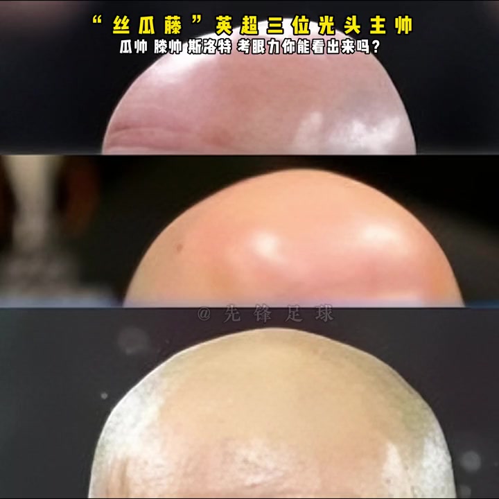 眼力大考验！曼联曼城利物浦三光头你能一一分辨吗????