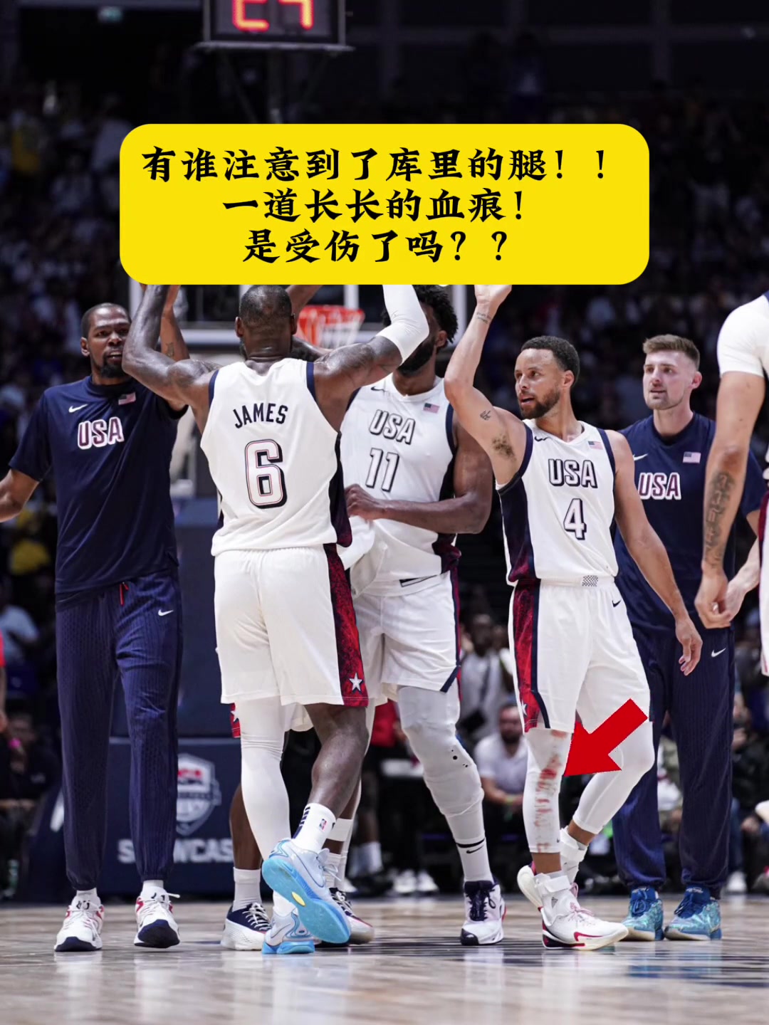 /video/nba/256321.html