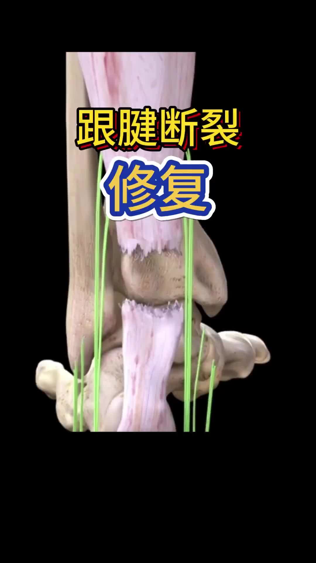 /video/nba/295714.html