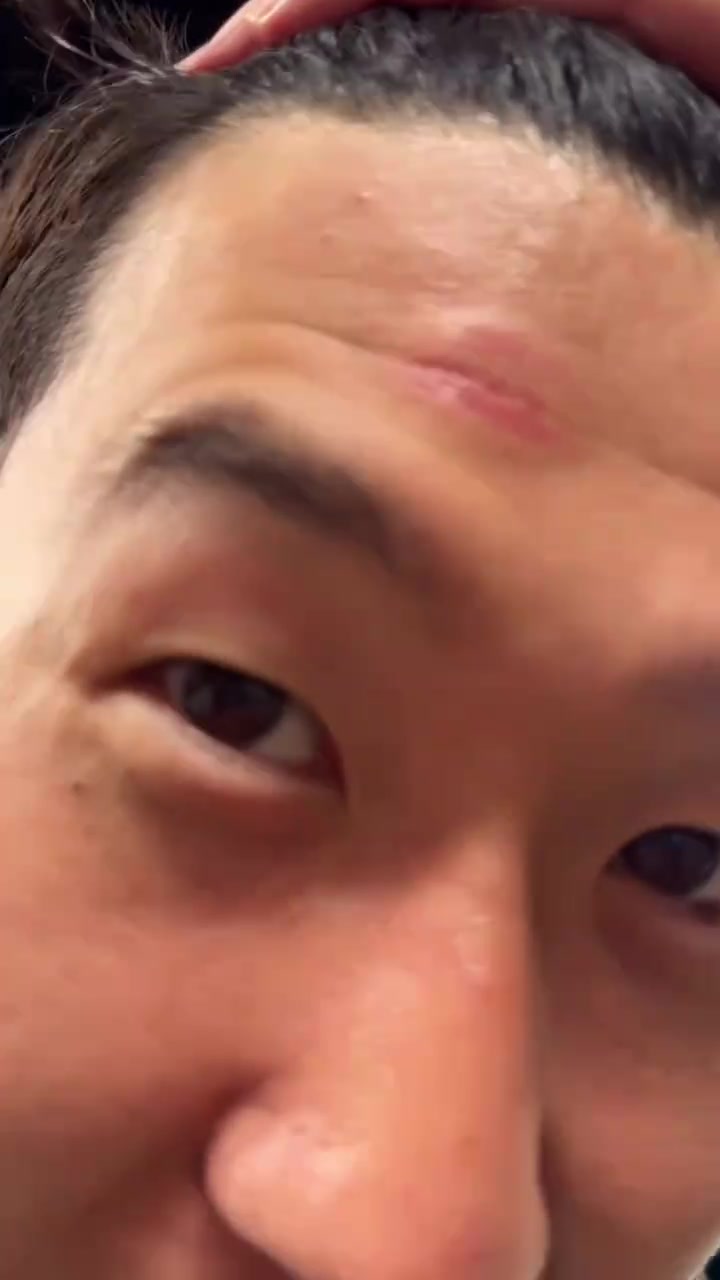 脑门肿了！孙兴慜被人推撞到了奖杯，但孙哥高兴得合不拢嘴?