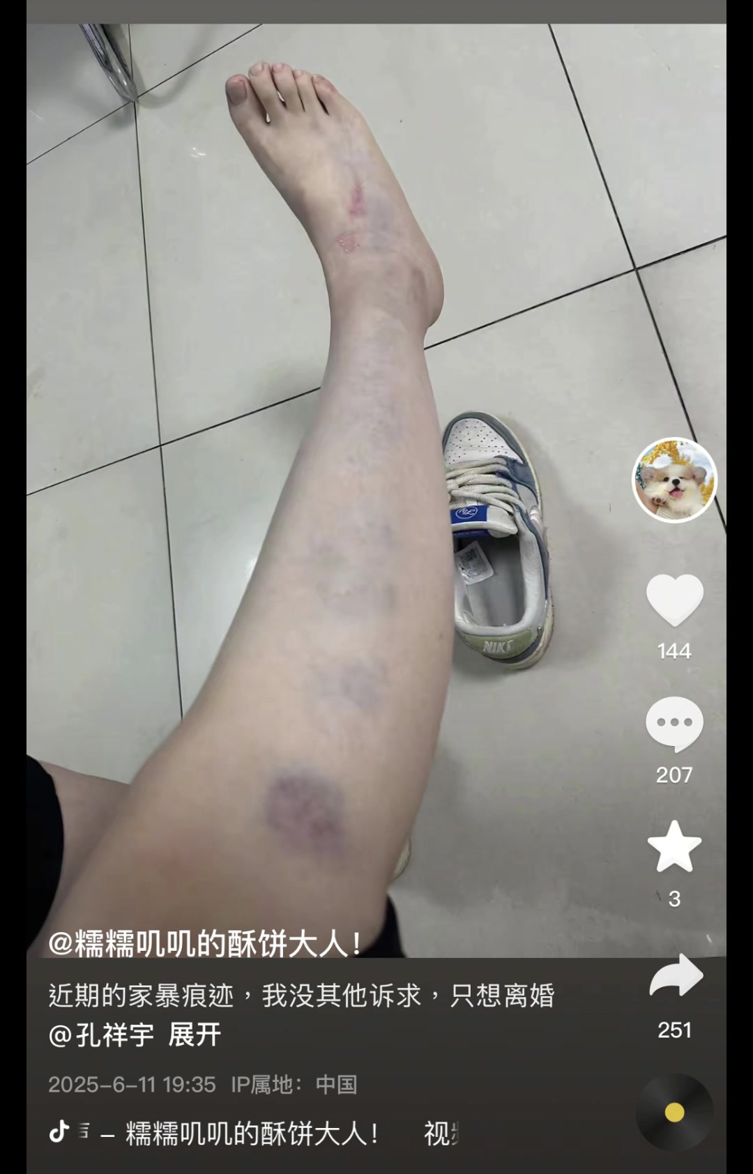 ?涉及篮球女主播？解说员孔祥宇妻子社媒晒家暴痕迹&申请离婚