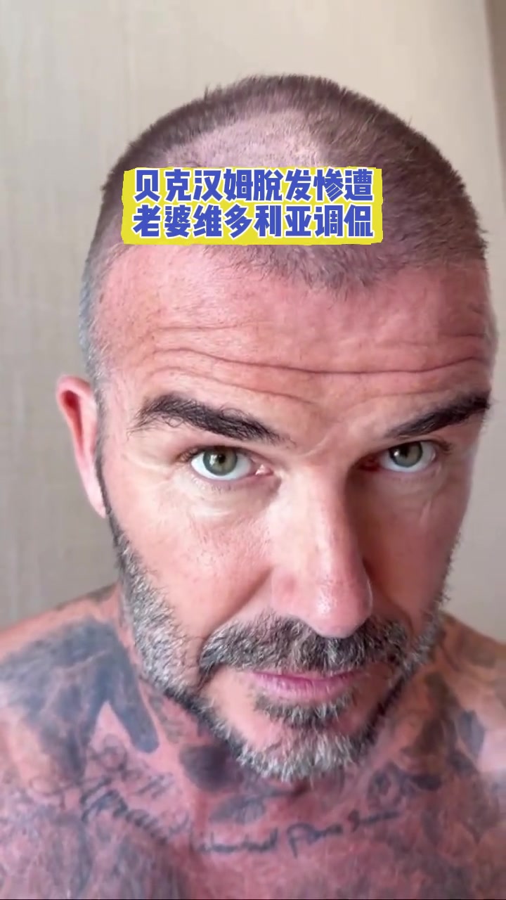 小贝也有中年危机?贝克汉姆脱发惨遭老婆维多利亚调侃